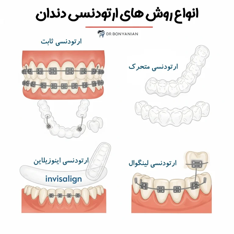اینفوگرافی انواع روش های ارتودنسی
